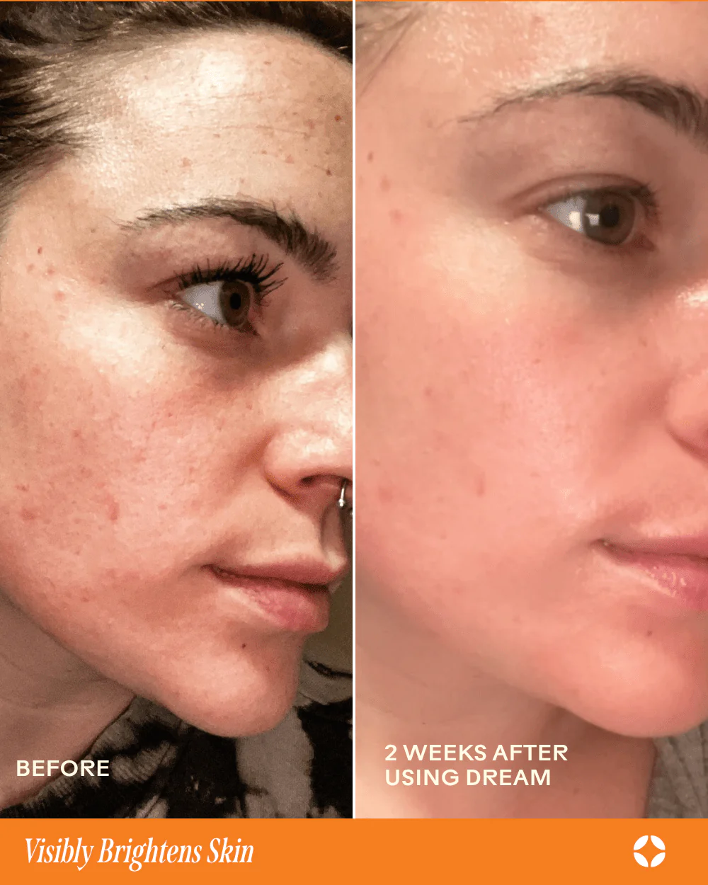 Dream Bio-Retinol + Shorea Butter Rejuvenating Cream - Image 5