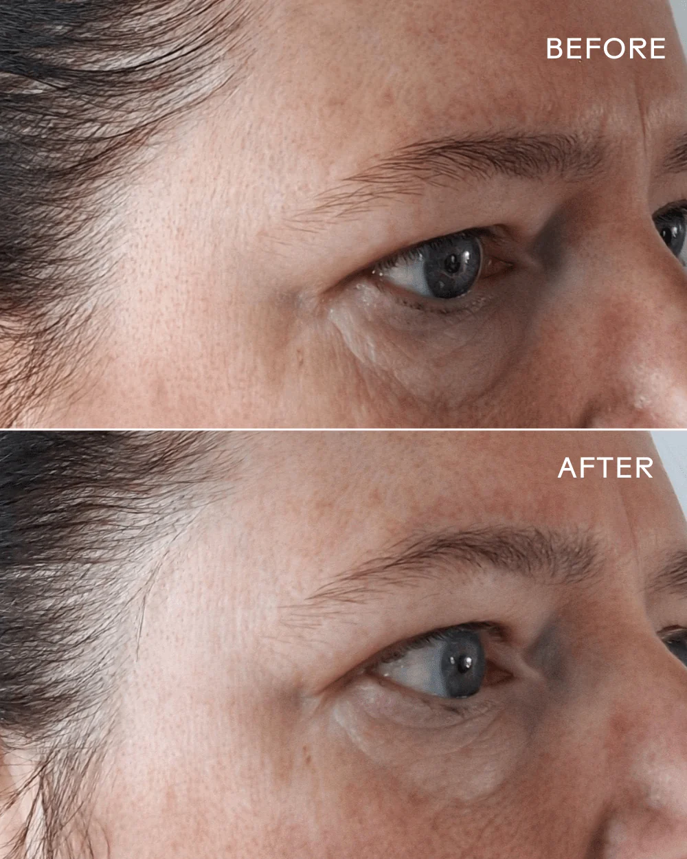 EyeHero ® Bio-Retinol Smoothing Eye Cream - Image 5