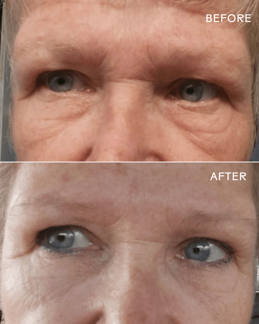 EyeHero ® Bio-Retinol Smoothing Eye Cream - Image 6