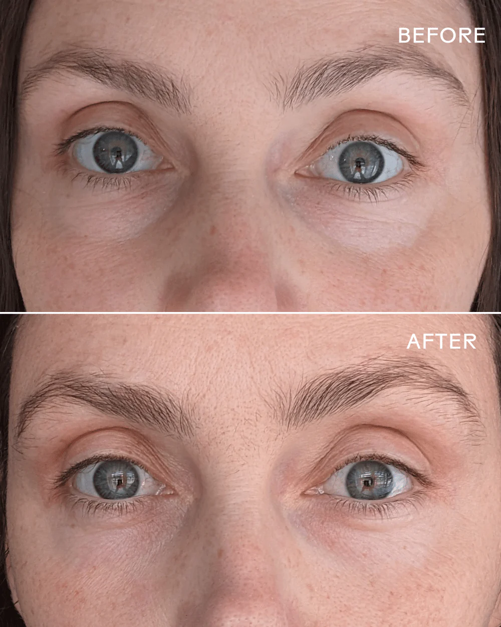 First Light® Vitamin C + Caffeine Eye Cream - Image 6