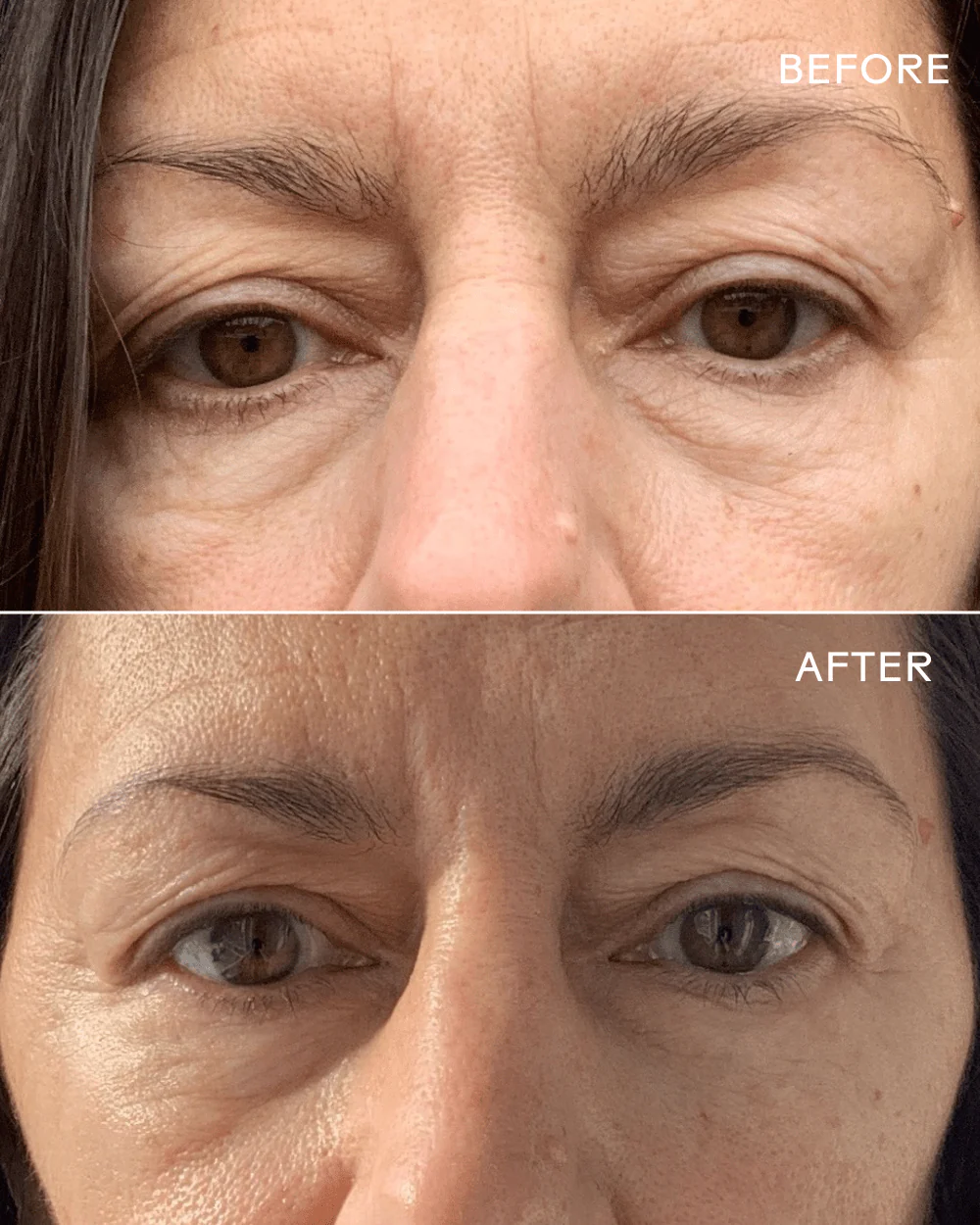 First Light® Vitamin C + Caffeine Eye Cream - Image 7