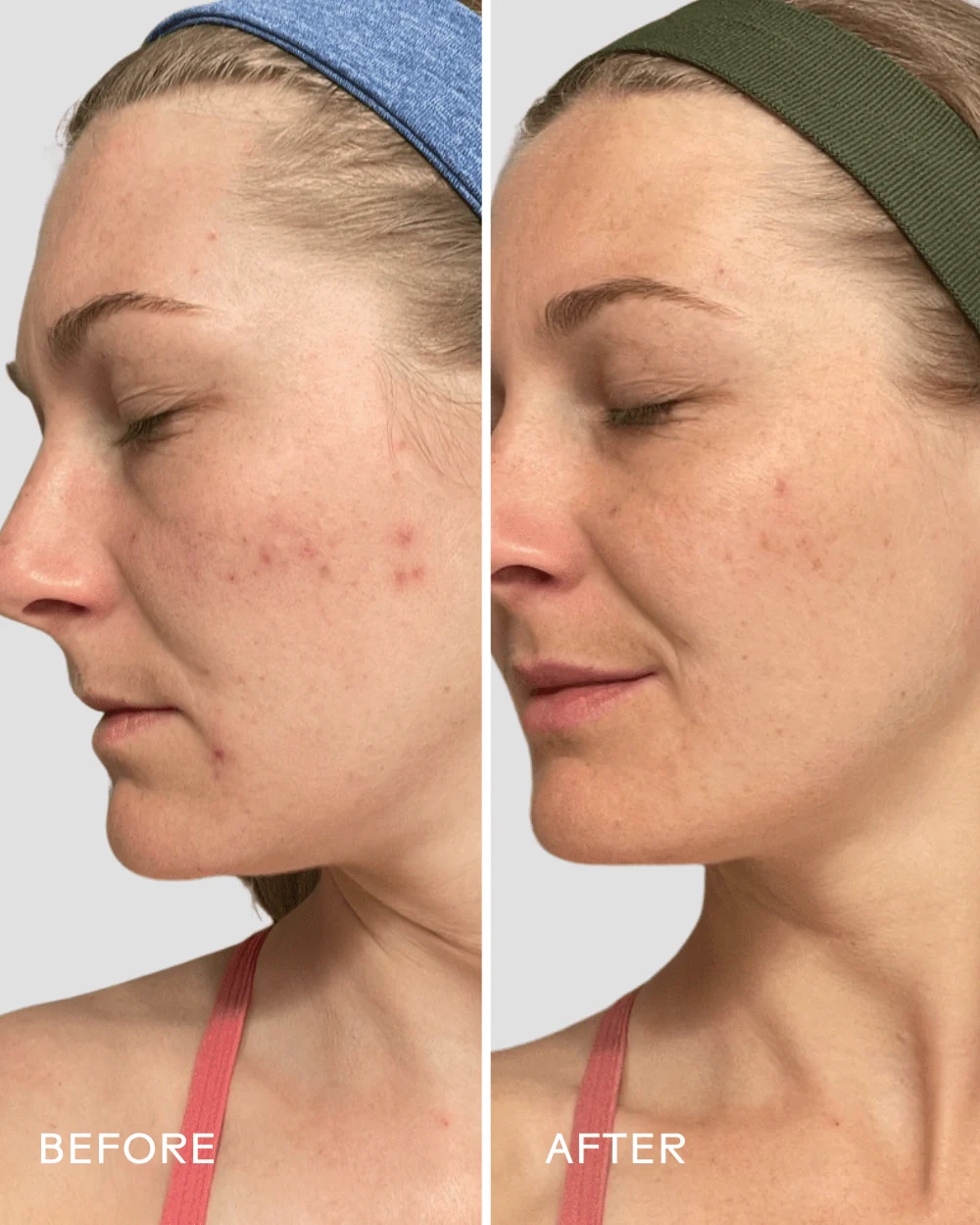 Refresh Papaya + Salicylic Acid Cleanser - Image 5