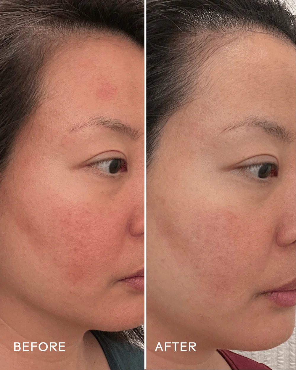 Replenish Ceramides + Blueberry Barrier Repair Serum - Image 5