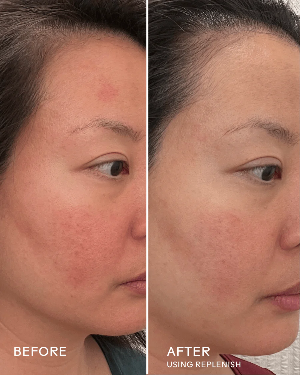 Skin Barrier Reset Routine - Image 10