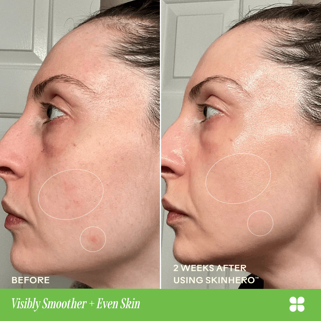 SkinHero™ Calendula + 2% Bakuchiol Bio-Retinol Serum - Image 6