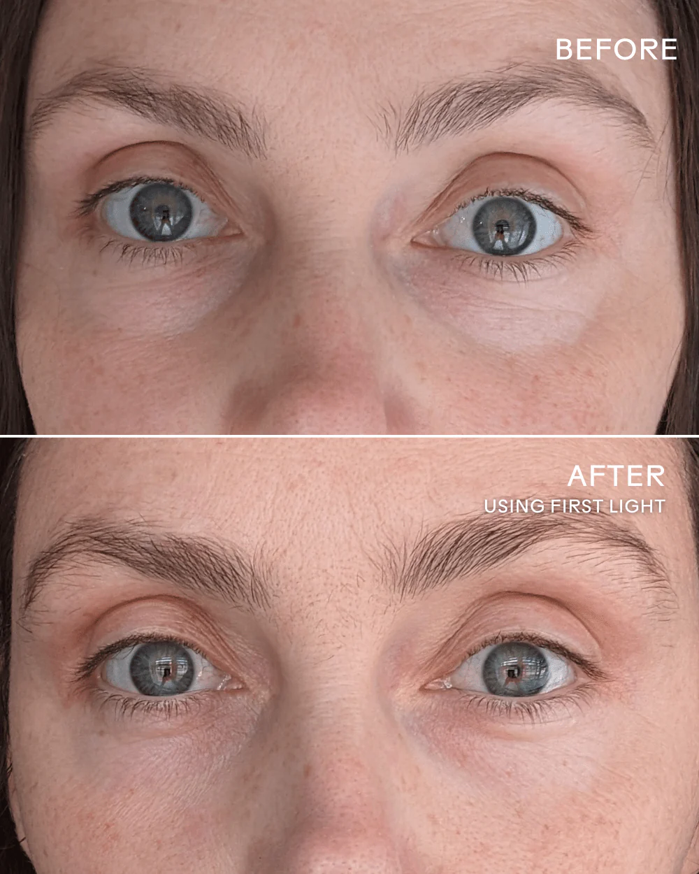 Under-Eye Brightening Duo - Image 4