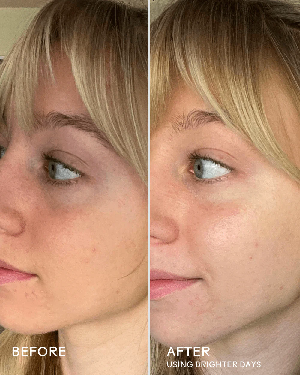 Under-Eye Brightening Duo - Image 5